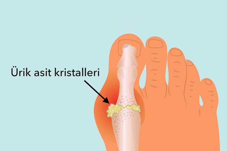 Gut İle Biten Kelimeler: Türkçe ve Fransızca Kökenli Kelimeler